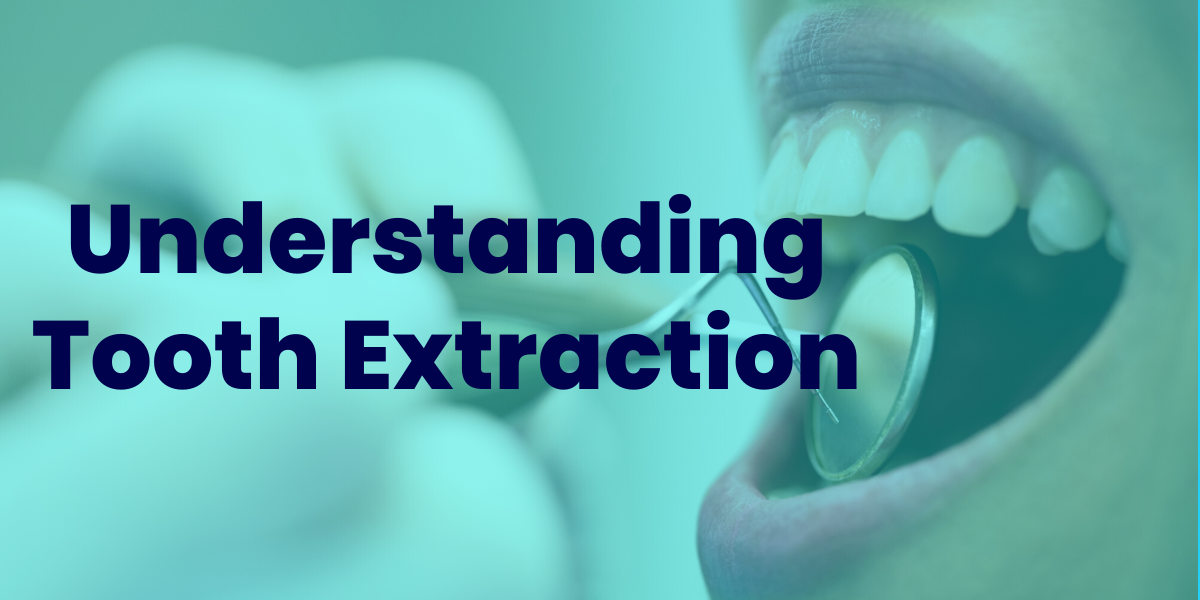 Understanding Tooth Extraction.